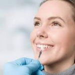 The Art of Personalized Veneers by Dr. Wade Newman